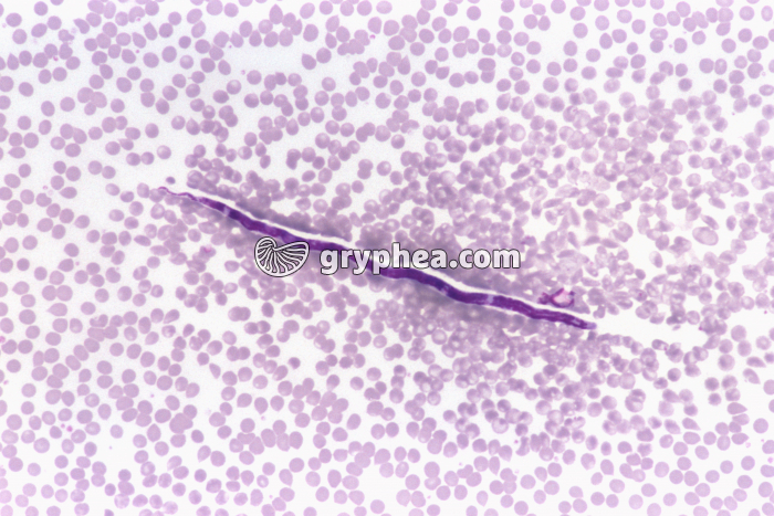 Microfilaire x100 - gryphea.com